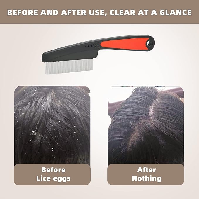 Flea Comb, Dandruff Comb, Multifunction Stainless Steel Fine Tooth Comb Nit Removal Hair Comb Cat Dog Pet Grooming Scalp Flea Comb, Easy to Hold