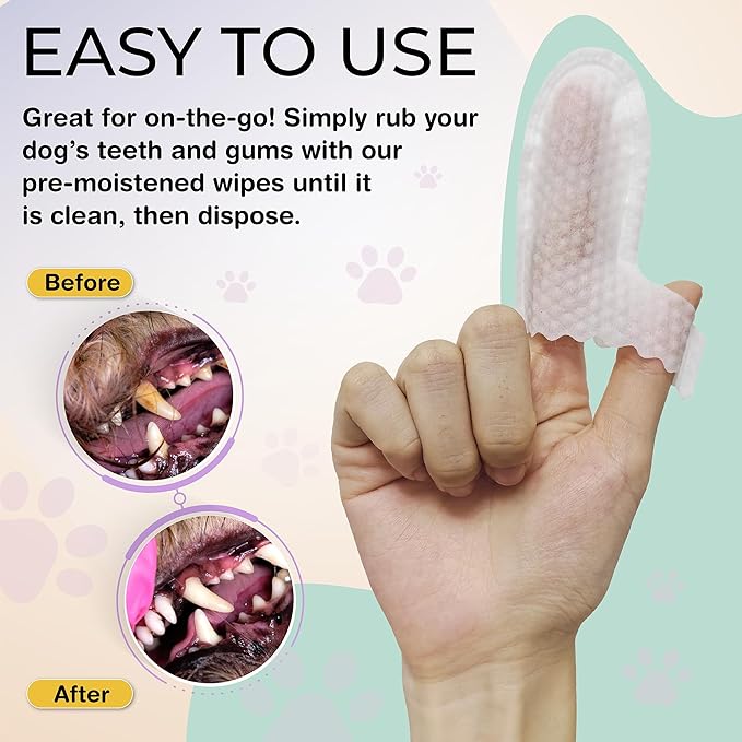 40 Dog Teeth Wipes - Dog Teeth Cleaning Products - Dog Dental Wipes - Teeth Cleaner for Dogs - Dog Tooth Cleaner - Dental Care for Dogs - Dog Tooth Brushing Kit - Dog Teeth Cleaning Kit - Dog Wipes